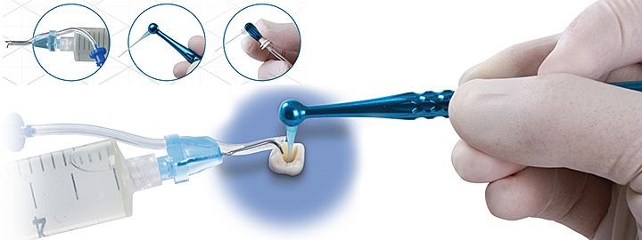 (image for) EndoVac - Apical Negative Pressure - Irrigation System