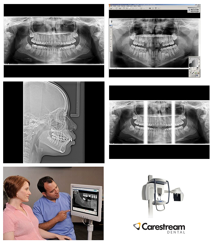 (image for) CS-8000C - Digital Panoramic and Cephalometric System