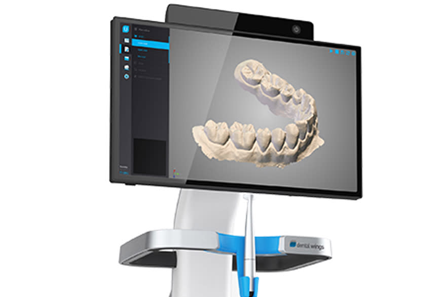 (image for) Intra-oral Scanner