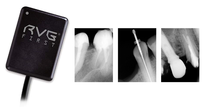 (image for) RVG First - Intraoral Sensor - Size 1